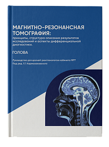 Магнитно-резонансная томография: Голова