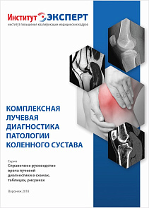 Методическое пособие: «Комплексная лучевая диагностика патологии коленного сустава»