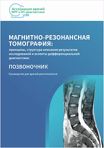 Магнитно-резонансная томография: Позвоночник